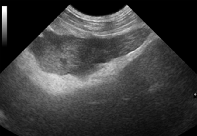 Abdominal ultrasound scan used to diagnose pancreatitis in a dog
